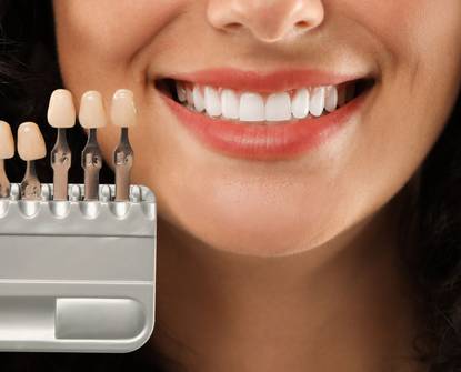 Kako ljuskice za zube mogu transformirati vaš osmijeh