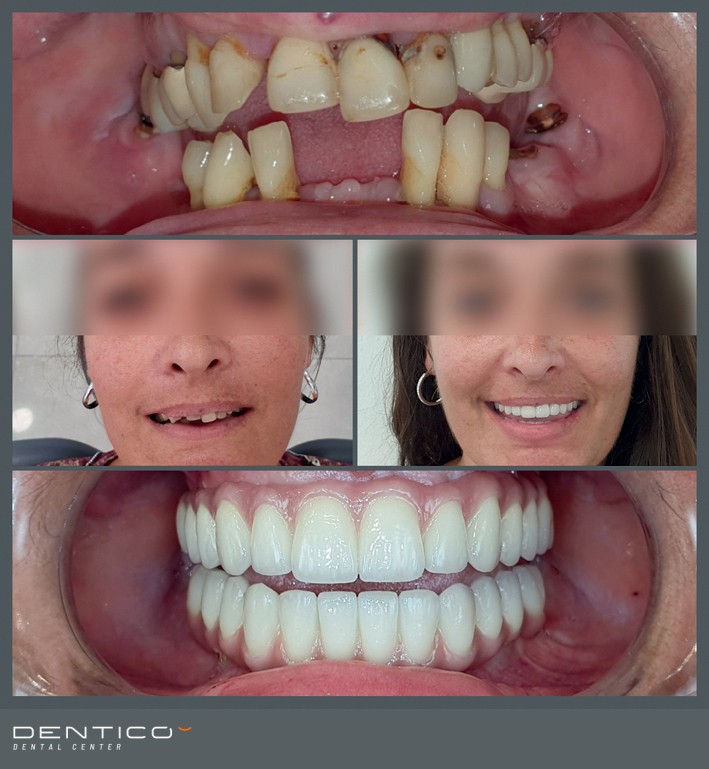 Radovi - prije i poslije 02