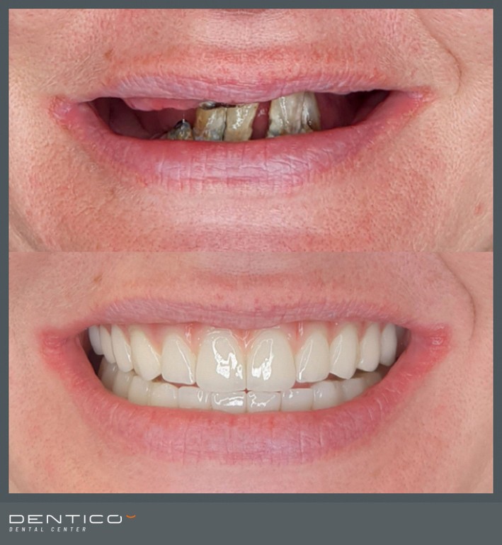 Radovi - prije i poslije 03