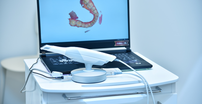 Digitalni otisci u stomatologiji: Brže, točnije i bez neugode
