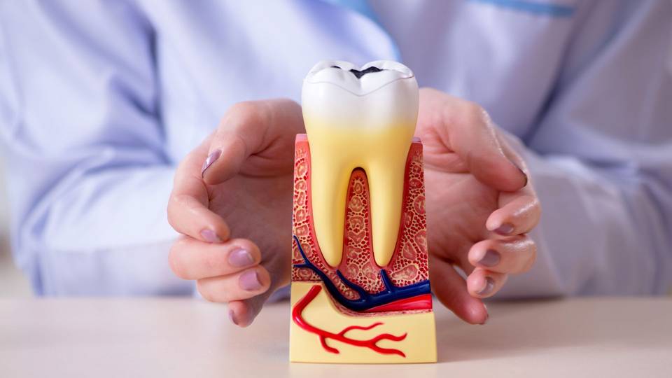 Što učiniti kada imate upalu živca zuba: Tretmani i prevencija