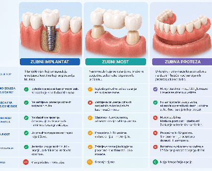 Implantat, most ili proteza – što je najbolje rješenje za nadomještanje zuba?