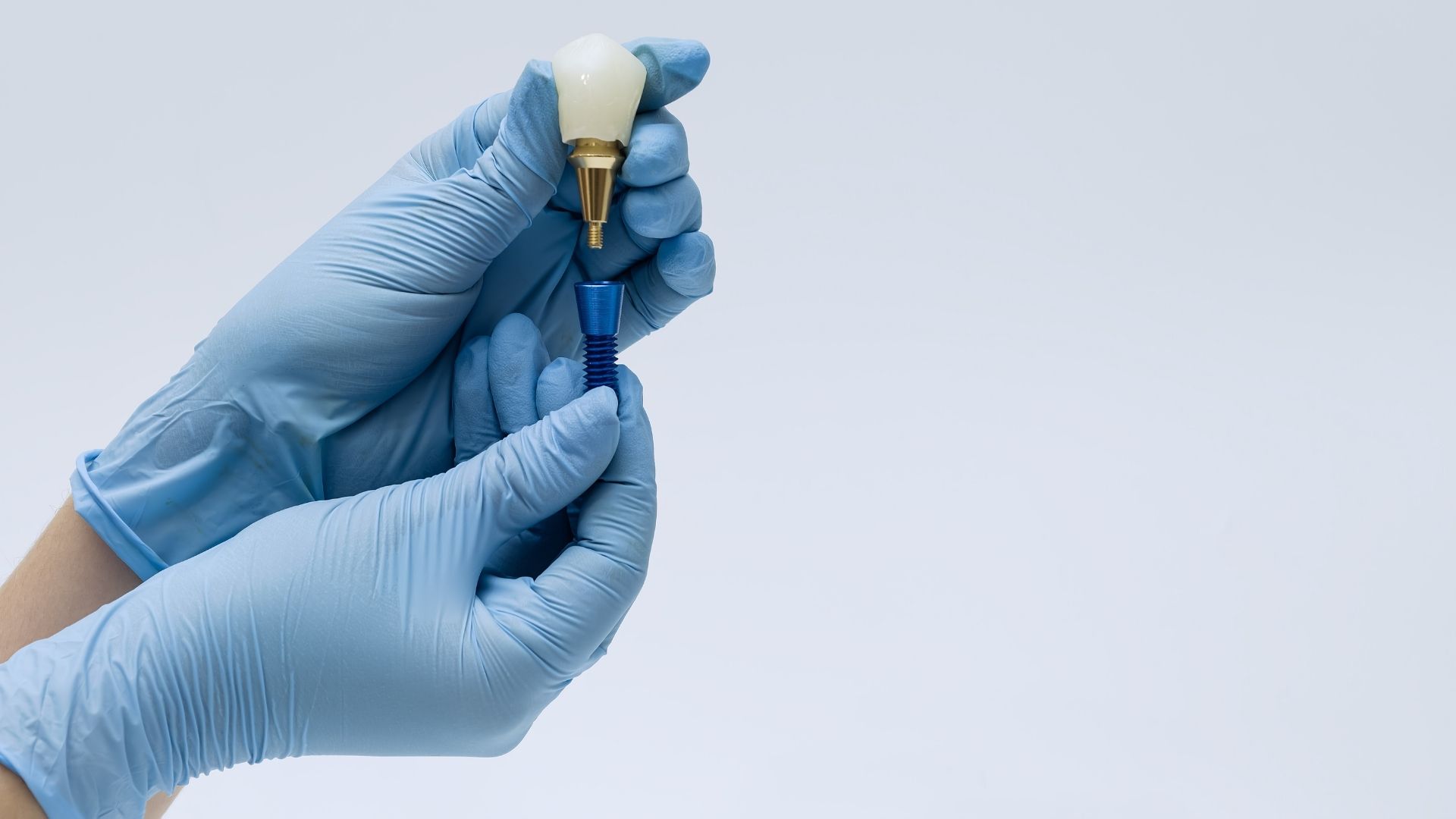 mini implantat rijeka