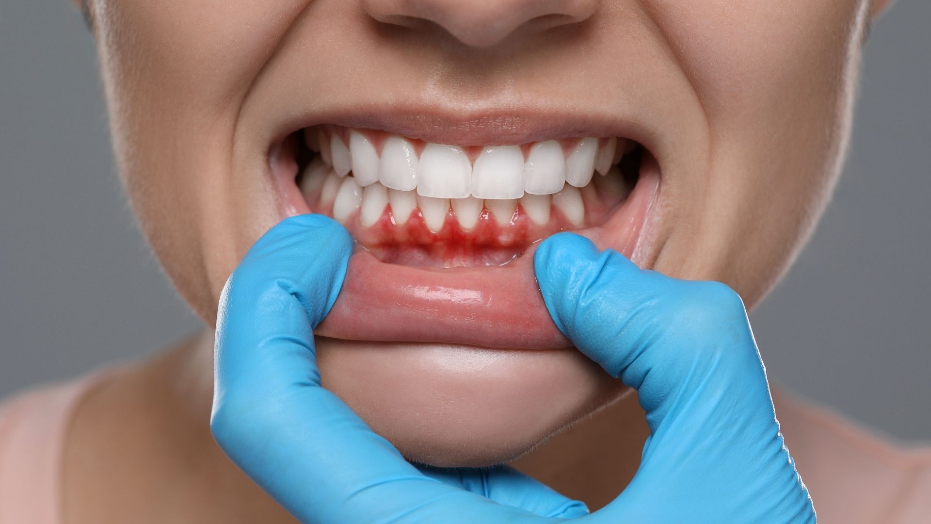 dentico rijeka