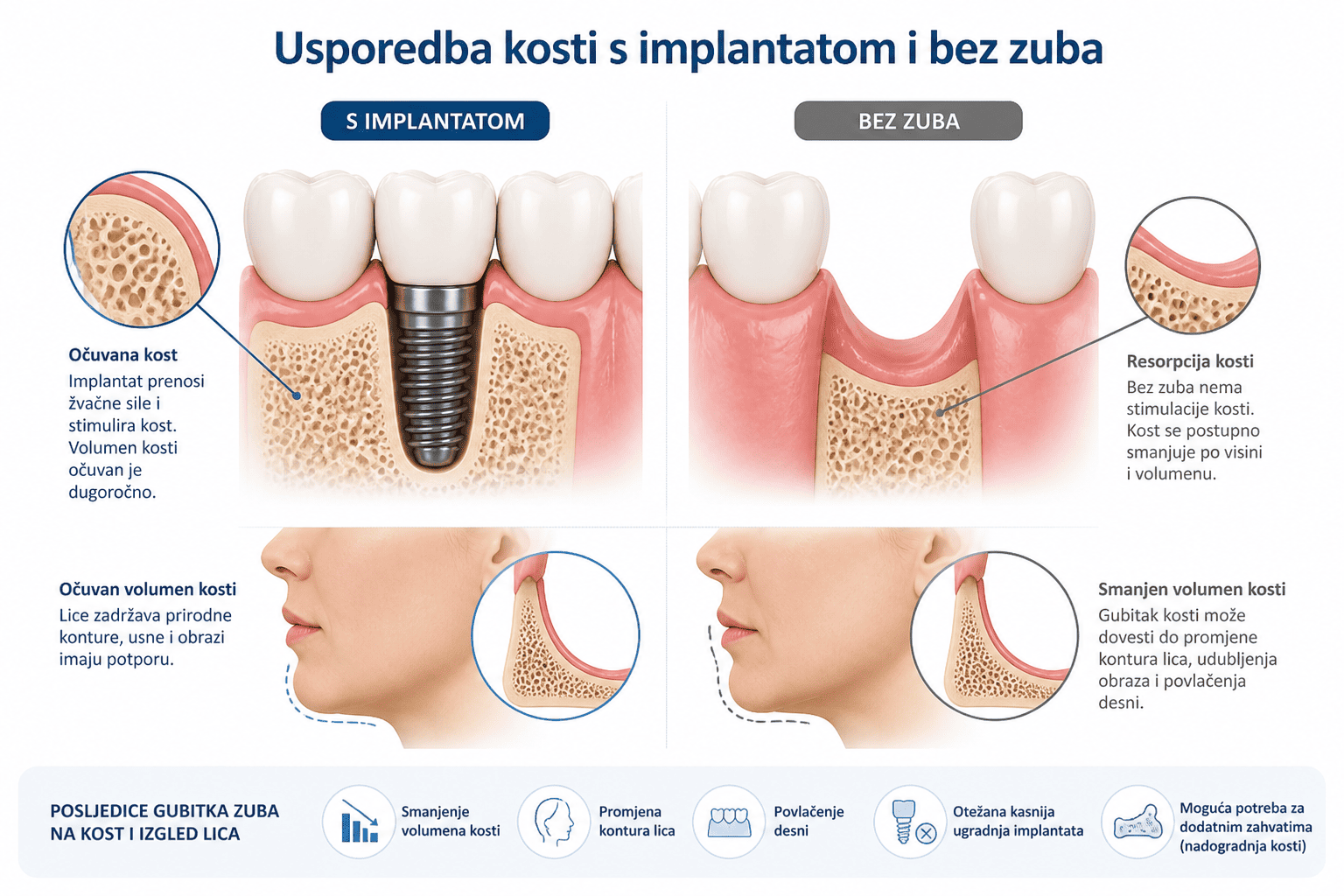 usporedba kosti sa i bez zuba